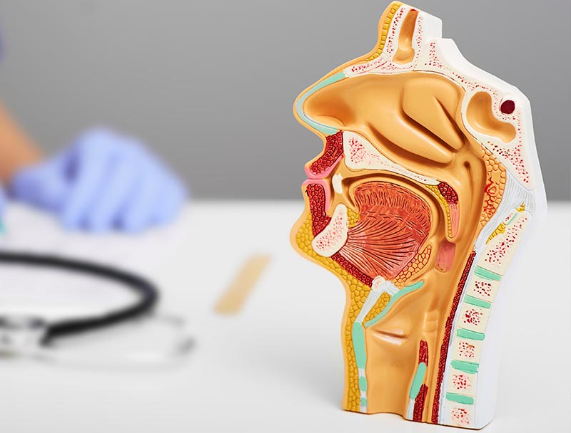 extragere corpi straini